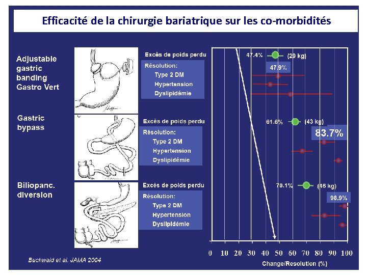 Efficacité de la chirurgie bariatrique sur les co-morbidités 