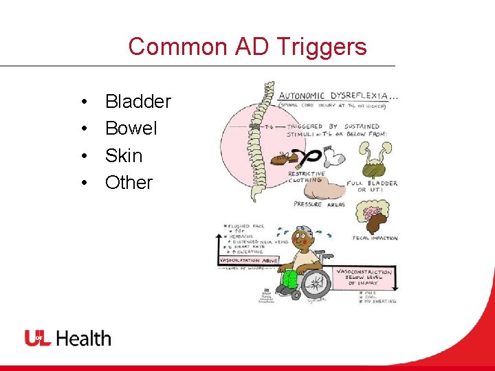 Common AD Triggers • • Bladder Bowel Skin Other 