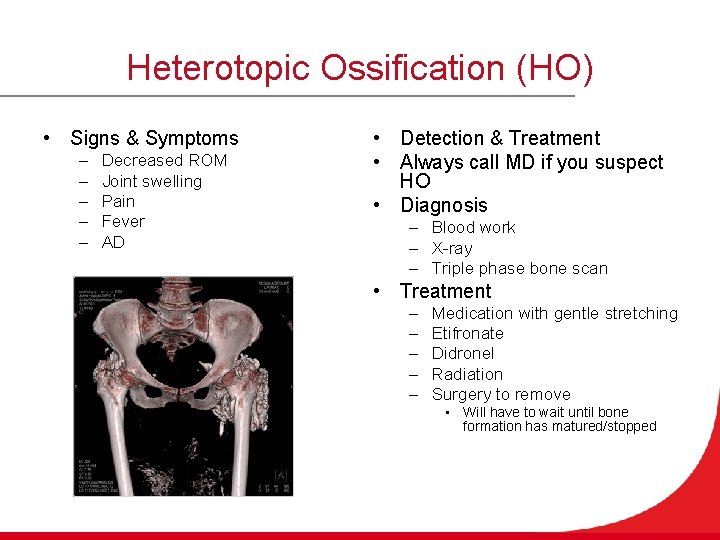 Heterotopic Ossification (HO) • Signs & Symptoms – – – Decreased ROM Joint swelling