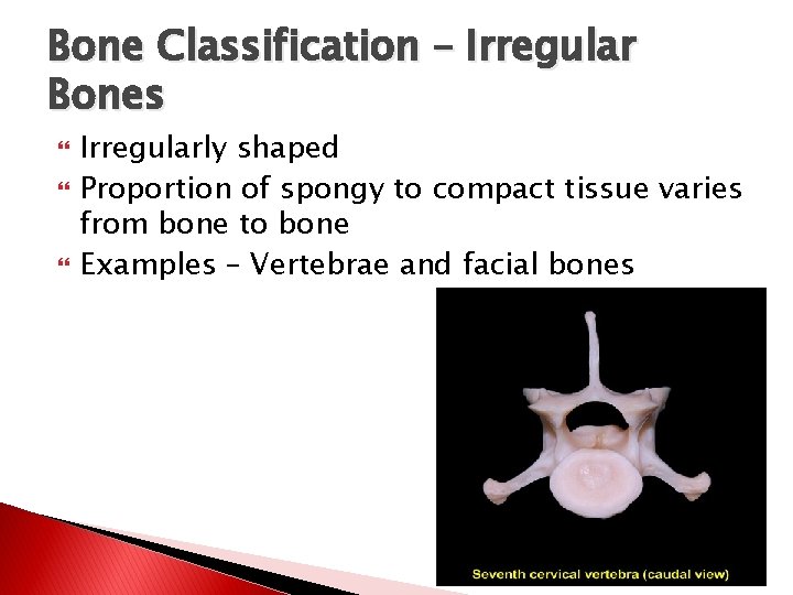 Bone Classification – Irregular Bones Irregularly shaped Proportion of spongy to compact tissue varies