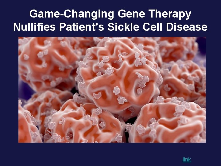 Game-Changing Gene Therapy Nullifies Patient's Sickle Cell Disease link 