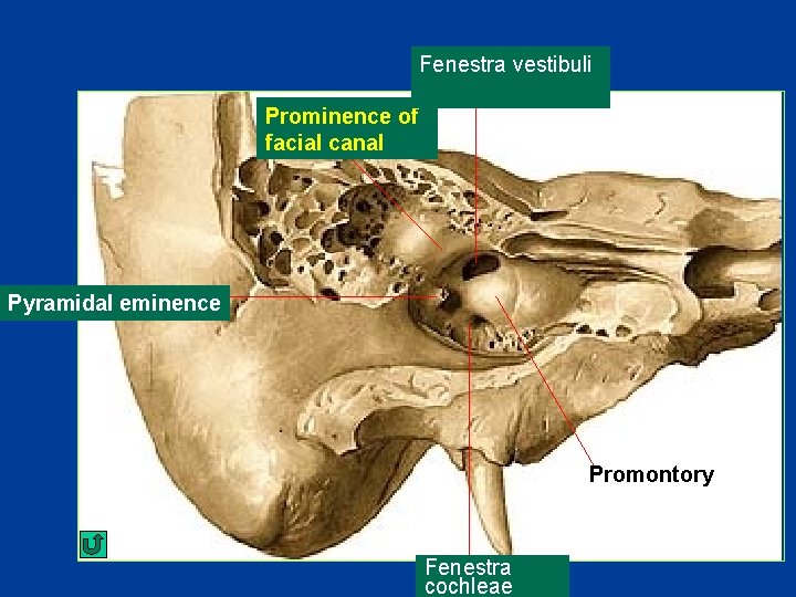 Fenestra vestibuli Prominence of facial canal Pyramidal eminence Promontory Fenestra cochleae 