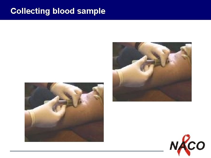 Collecting blood sample P 7 15 