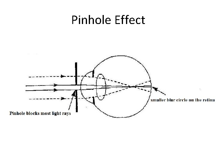 Pinhole Effect 