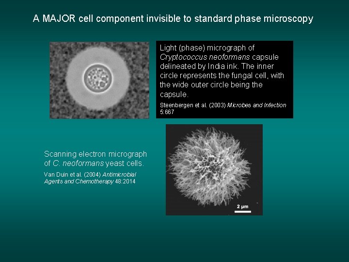 A MAJOR cell component invisible to standard phase microscopy Light (phase) micrograph of neoformans