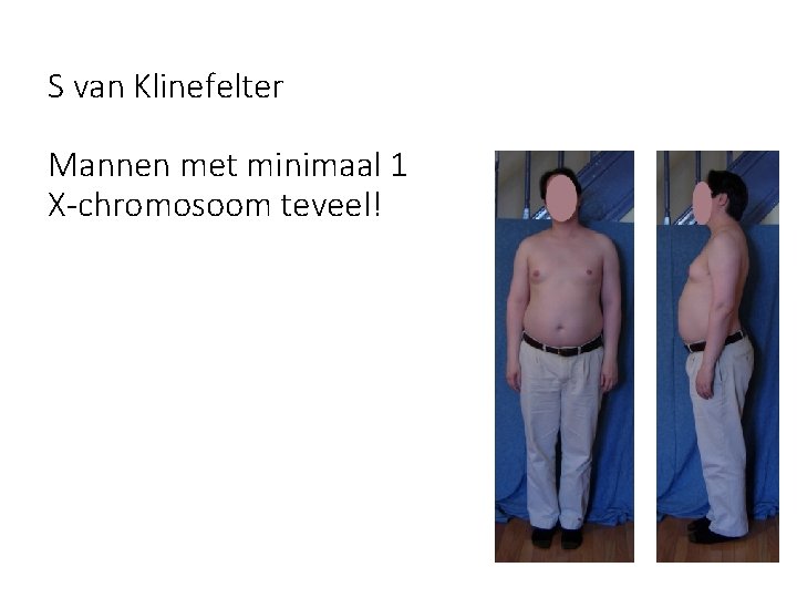 S van Klinefelter Mannen met minimaal 1 X-chromosoom teveel! 