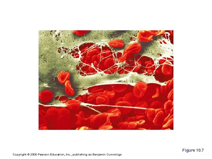 Fibrin Clot Figure 10. 7 Copyright © 2006 Pearson Education, Inc. , publishing as