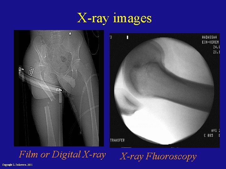 X-ray images Film or Digital X-ray Copyright L. Joskowicz, 2011 X-ray Fluoroscopy 