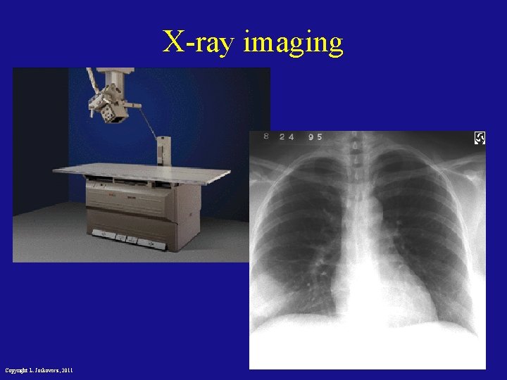 X-ray imaging Copyright L. Joskowicz, 2011 