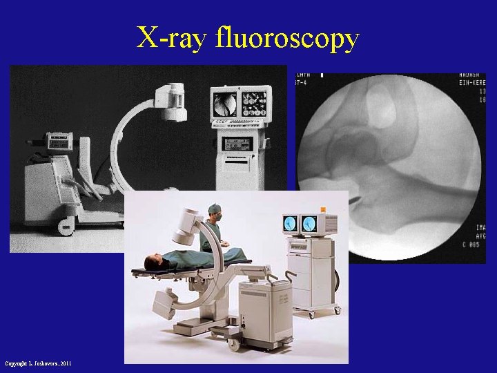 X-ray fluoroscopy Copyright L. Joskowicz, 2011 