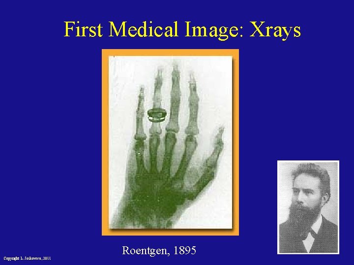 First Medical Image: Xrays Copyright L. Joskowicz, 2011 Roentgen, 1895 