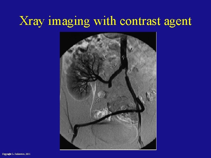 Xray imaging with contrast agent Copyright L. Joskowicz, 2011 