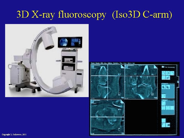 3 D X-ray fluoroscopy (Iso 3 D C-arm) Copyright L. Joskowicz, 2011 