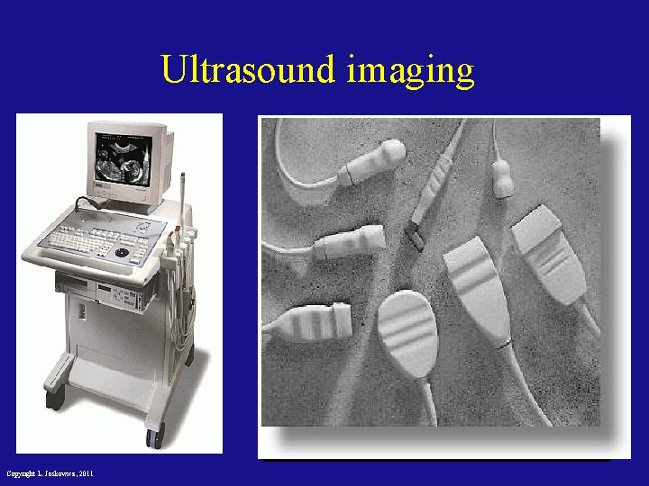 Ultrasound imaging Copyright L. Joskowicz, 2011 