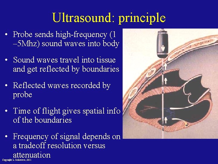 Ultrasound: principle • Probe sends high-frequency (1 – 5 Mhz) sound waves into body