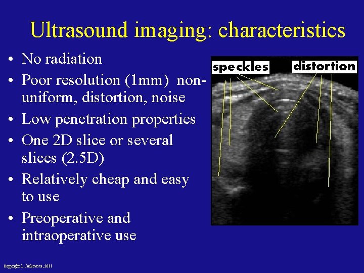 Ultrasound imaging: characteristics • No radiation • Poor resolution (1 mm) nonuniform, distortion, noise
