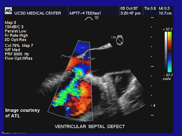 Copyright L. Joskowicz, 2011 