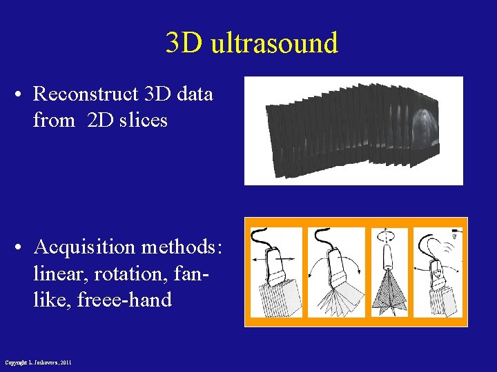 3 D ultrasound • Reconstruct 3 D data from 2 D slices • Acquisition