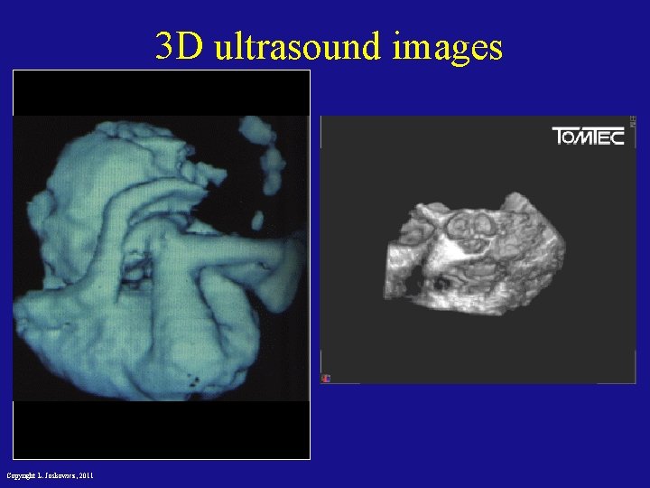 3 D ultrasound images Copyright L. Joskowicz, 2011 