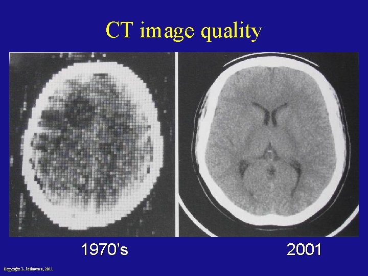 CT image quality 1970’s Copyright L. Joskowicz, 2011 2001 