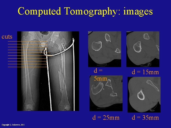 Computed Tomography: images cuts Copyright L. Joskowicz, 2011 d= 5 mm d = 15