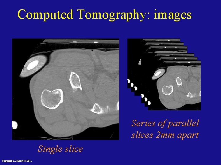 Computed Tomography: images Series of parallel slices 2 mm apart Single slice Copyright L.