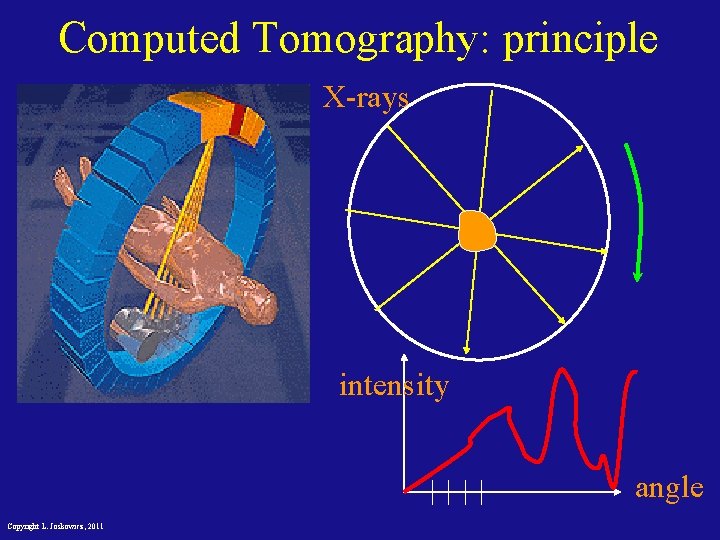 Computed Tomography: principle X-rays intensity angle Copyright L. Joskowicz, 2011 