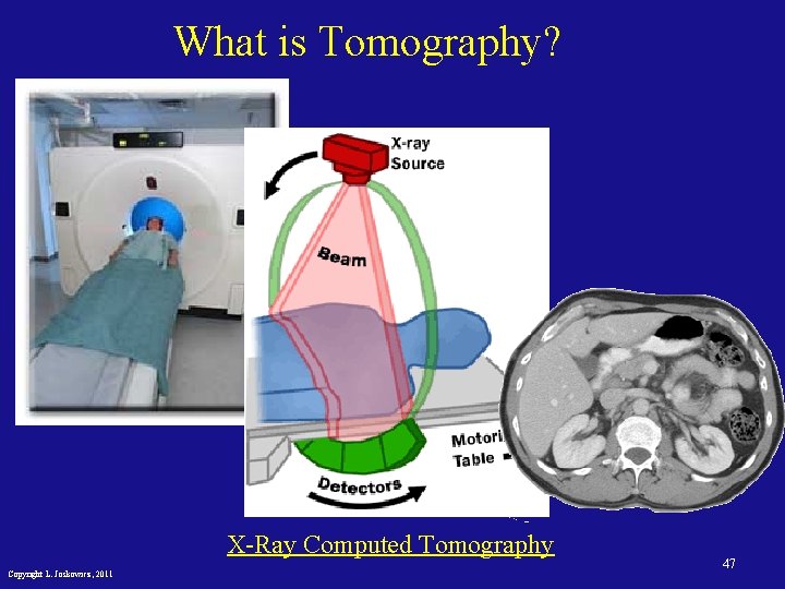 What is Tomography? X-Ray Computed Tomography Copyright L. Joskowicz, 2011 47 