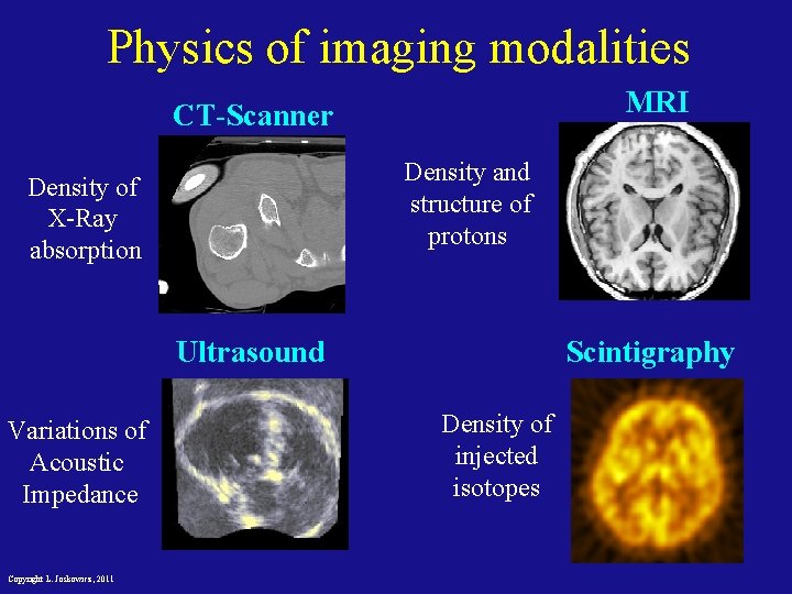 Physics of imaging modalities MRI CT-Scanner Density and structure of protons Density of X-Ray