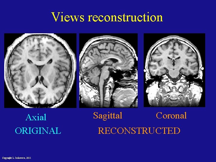 Views reconstruction Axial ORIGINAL Copyright L. Joskowicz, 2011 Sagittal Coronal RECONSTRUCTED 