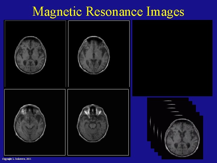 Magnetic Resonance Images Copyright L. Joskowicz, 2011 