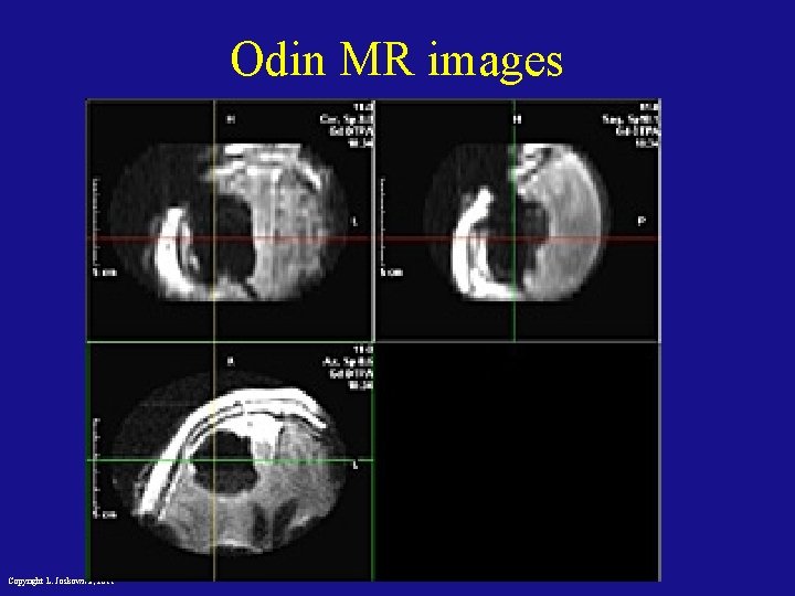 Odin MR images Copyright L. Joskowicz, 2011 