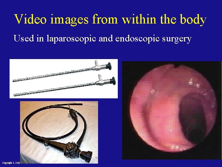 Video images from within the body Used in laparoscopic and endoscopic surgery Copyright L.