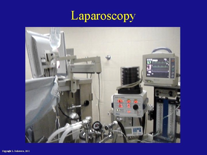 Laparoscopy Copyright L. Joskowicz, 2011 