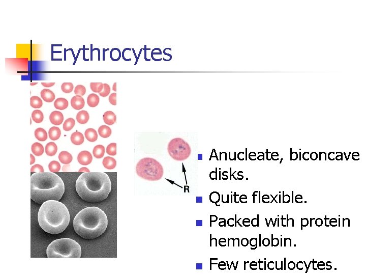 Erythrocytes n n Anucleate, biconcave disks. Quite flexible. Packed with protein hemoglobin. Few reticulocytes.
