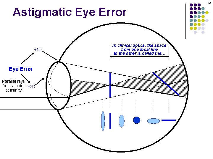 12 Astigmatic Eye Error +1 D In clinical optics, the space from one focal