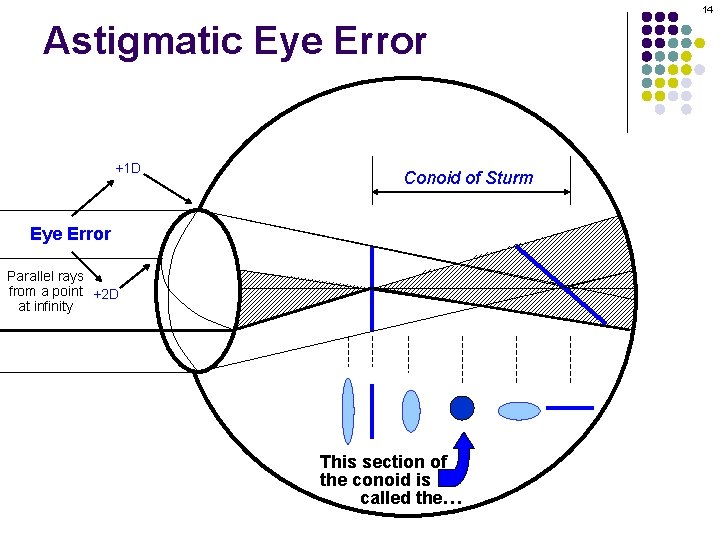 14 Astigmatic Eye Error +1 D Conoid of Sturm Eye Error Parallel rays from