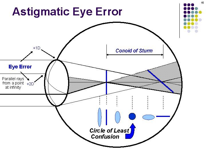 15 Astigmatic Eye Error +1 D Conoid of Sturm Eye Error Parallel rays from