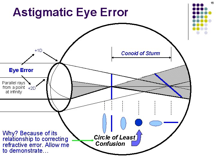16 Astigmatic Eye Error +1 D Conoid of Sturm Eye Error Parallel rays from