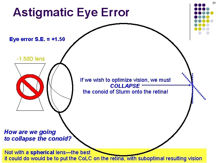 31 Astigmatic Eye Error Eye error S. E. = +1. 50 -1. 50 D