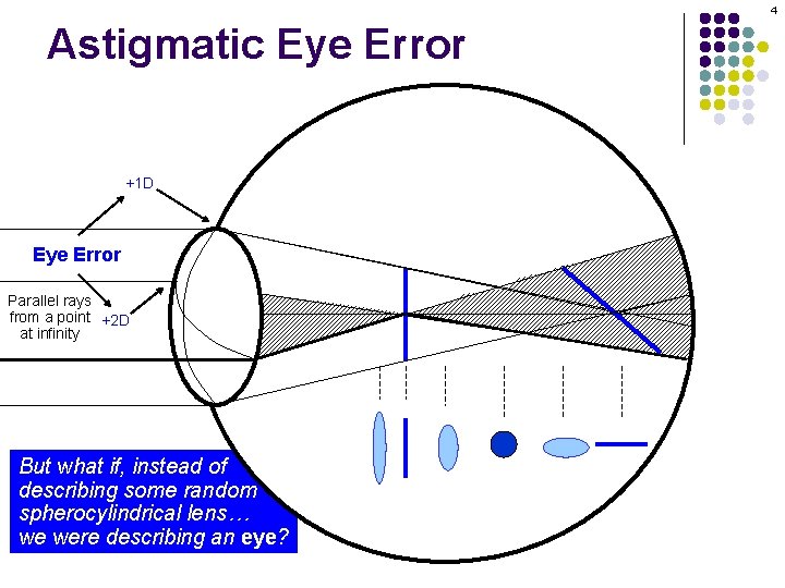 4 Astigmatic Eye Error +1 D Eye Error Parallel rays from a point +2