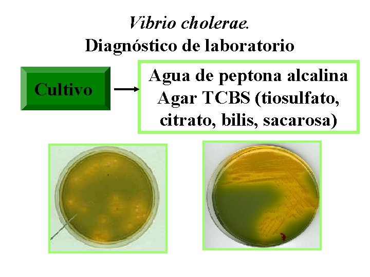 Vibrio cholerae. Diagnóstico de laboratorio Cultivo Agua de peptona alcalina Agar TCBS (tiosulfato, citrato,