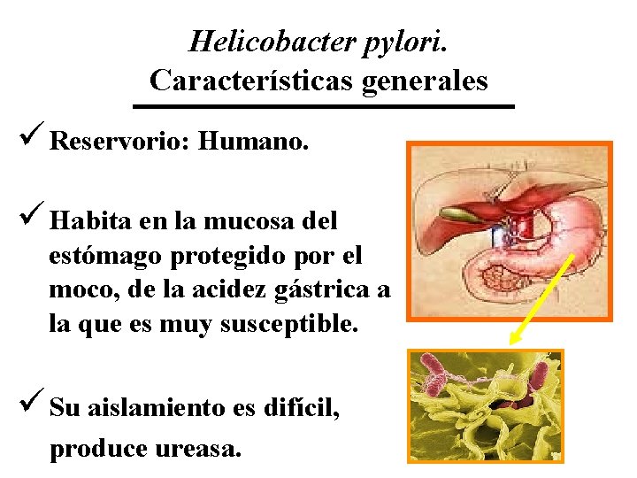 Helicobacter pylori. Características generales ü Reservorio: Humano. ü Habita en la mucosa del estómago