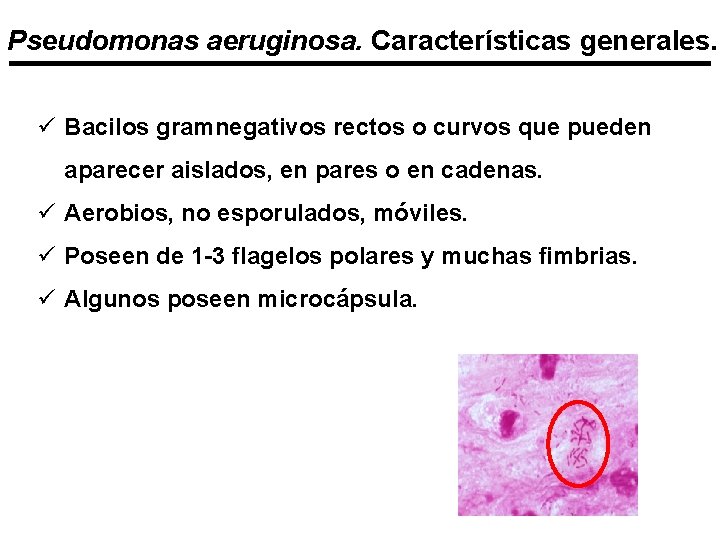 Pseudomonas aeruginosa. Características generales. ü Bacilos gramnegativos rectos o curvos que pueden aparecer aislados,