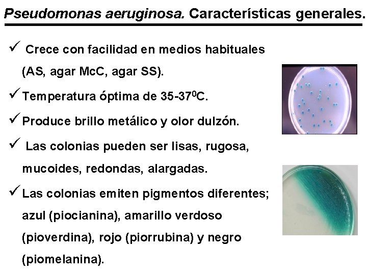 Pseudomonas aeruginosa. Características generales. ü Crece con facilidad en medios habituales (AS, agar Mc.