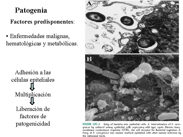 Patogenia Factores predisponentes: • Enfermedades malignas, hematológicas y metabólicas. Adhesión a las células epiteliales