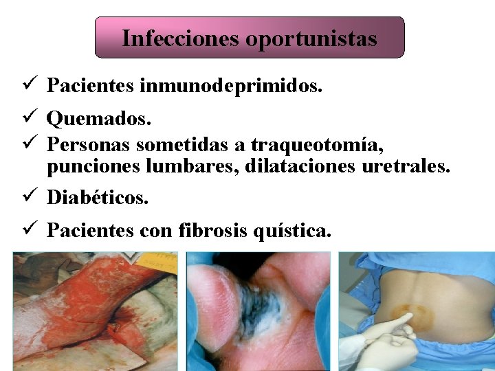 Infecciones oportunistas ü Pacientes inmunodeprimidos. ü Quemados. ü Personas sometidas a traqueotomía, punciones lumbares,