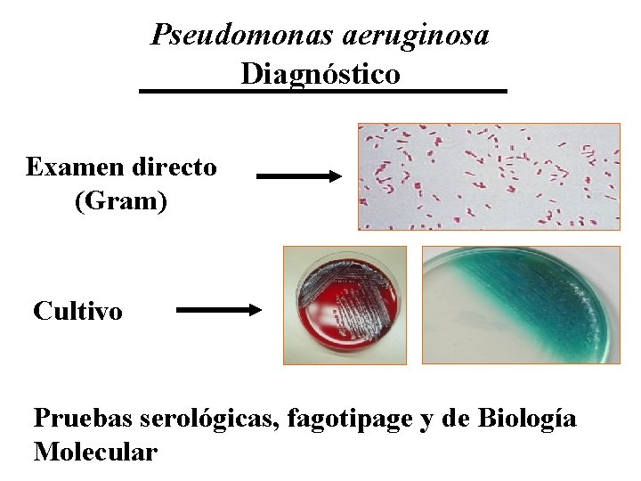 Pseudomonas aeruginosa Diagnóstico Examen directo (Gram) Cultivo Pruebas serológicas, fagotipage y de Biología Molecular