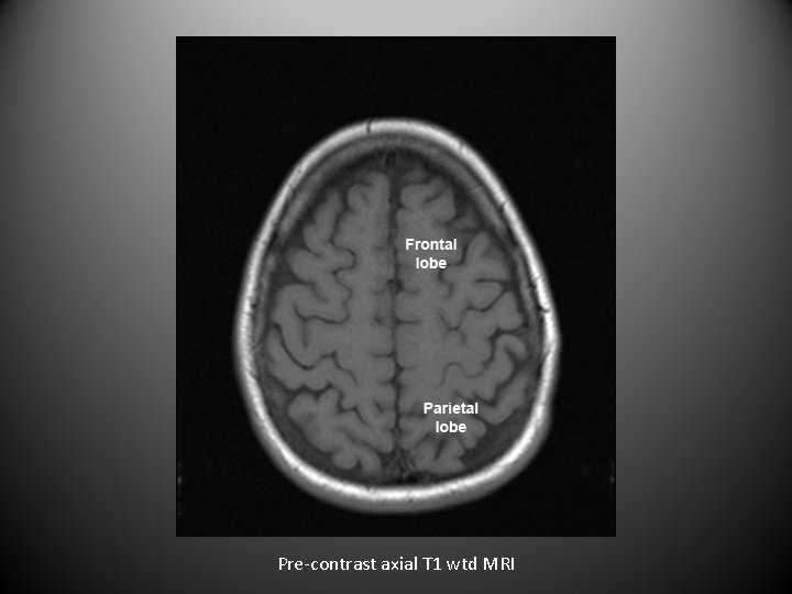 Pre-contrast axial T 1 wtd MRI 