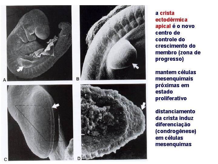 a crista ectodêrmica apical é o novo centro de controle do crescimento do membro